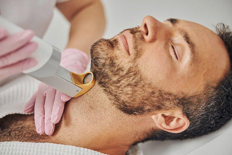 What is Laser Beard Shaping? Hair removal for men. – Daily Grind